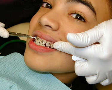 Kids Orlando: Orthodontists - Fun 4 Orlando Kids